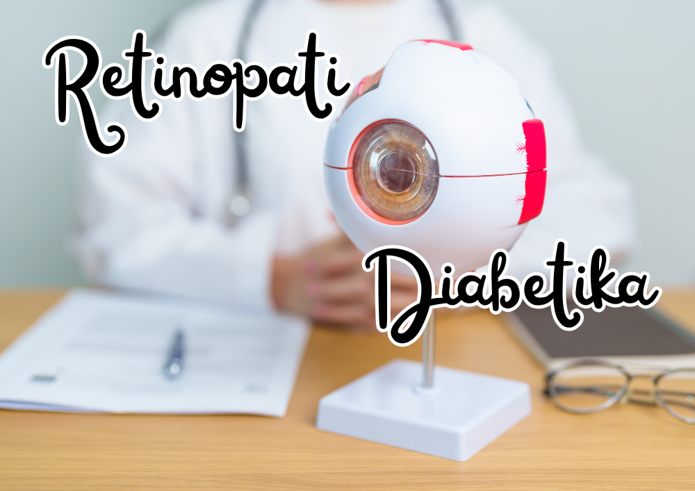 Retinopati Diabetika